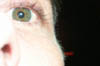 todd's fat eye